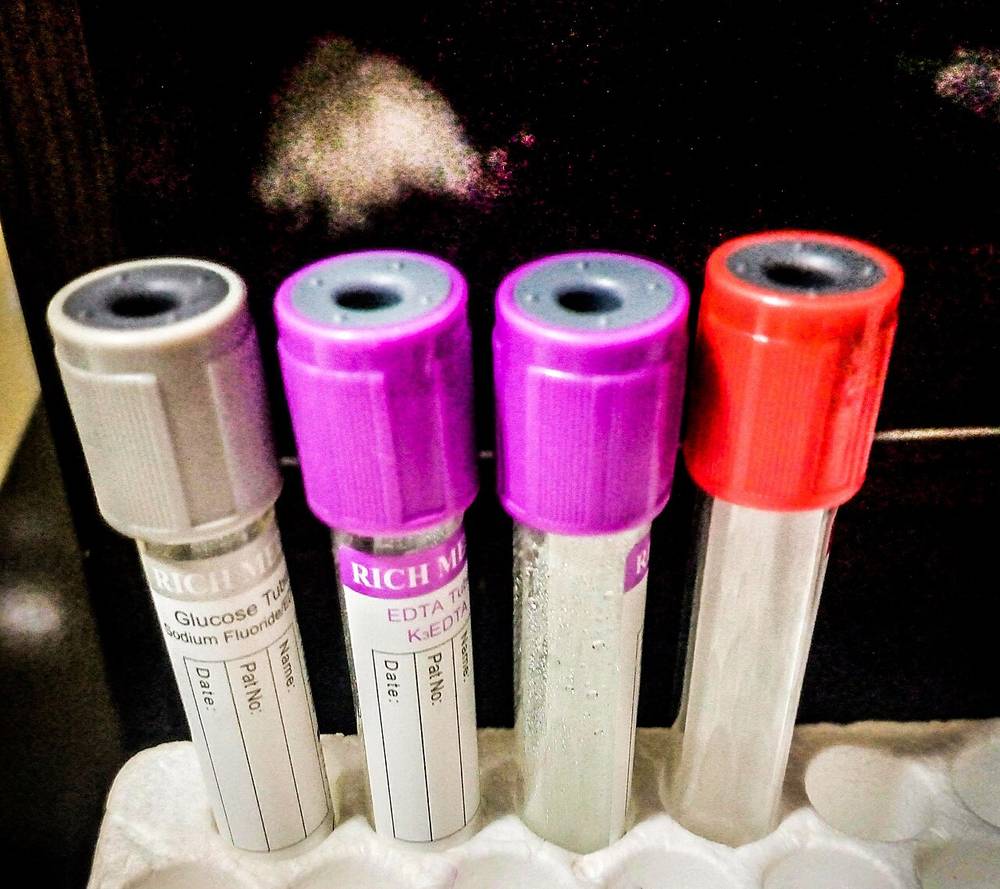 Provette da laboratorio con tappi colorati